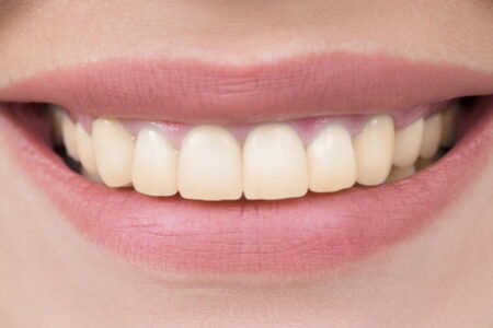 Pristine Dental Group