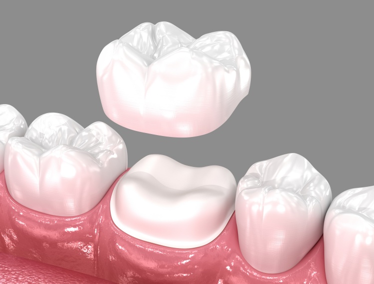 Pristine Dental Group