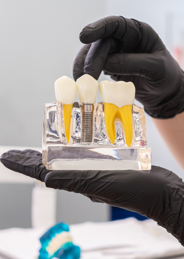 Treatments - Pristine Dental Group