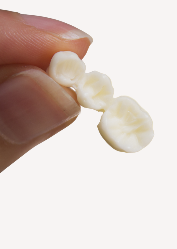 Treatments - Pristine Dental Group