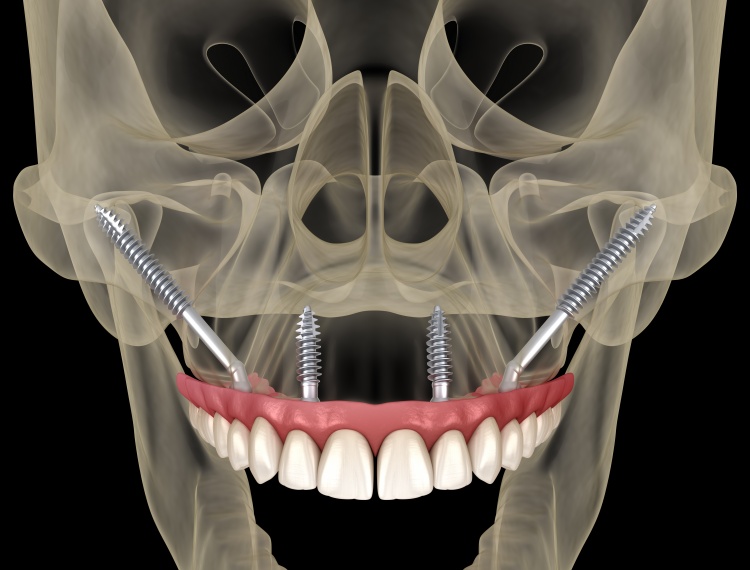 Pristine Dental Group