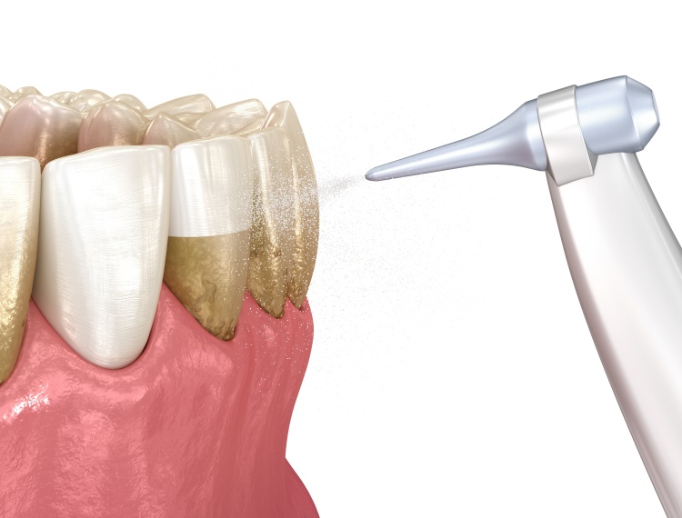 Pristine Dental Group