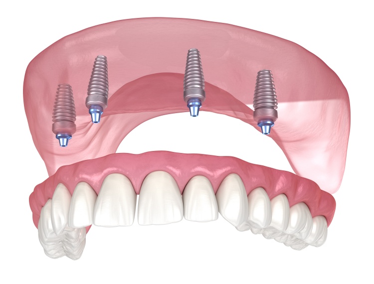 Pristine Dental Group