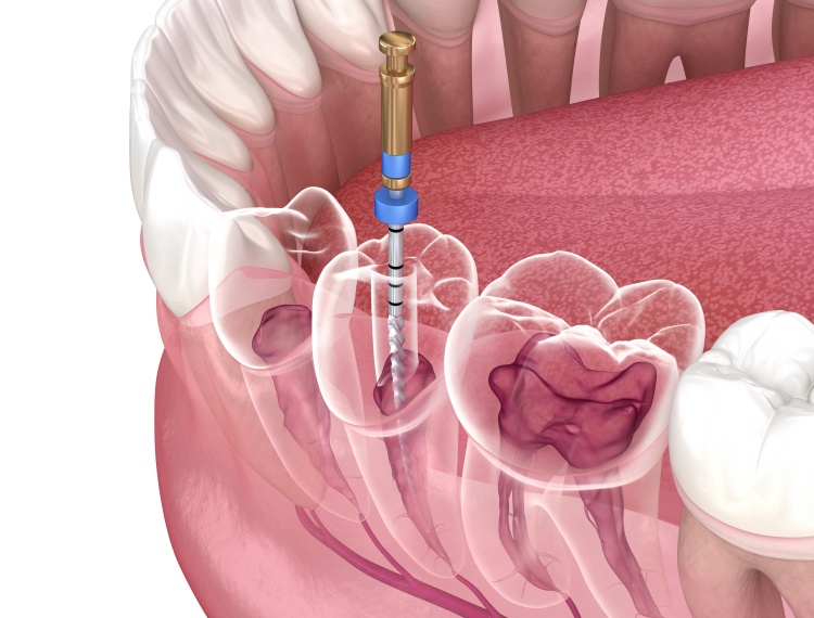 Pristine Dental Group