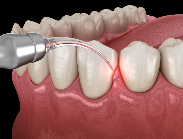 Pristine Dental Group