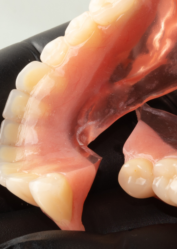 Broken Dentures